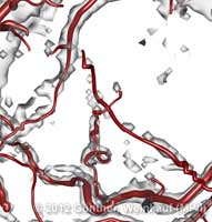 aneurism_lines_zoomIn