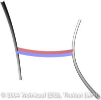 StreamSurfaceIntersectionConnector